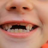 Сколько зубов у детей